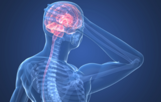 Types of Headaches & How Chiropractic Care Can Help