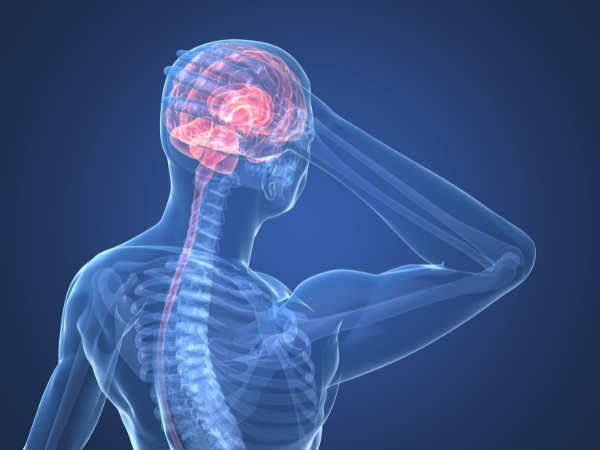 Types of Headaches & How Chiropractic Care Can Help